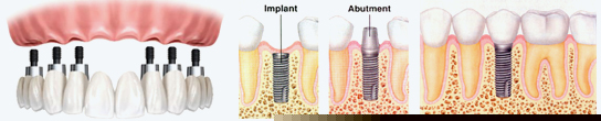 Dental Concept - About Us
